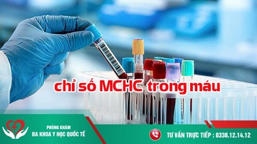 Ý nghĩa chỉ số MCHC trong máu là gì ?