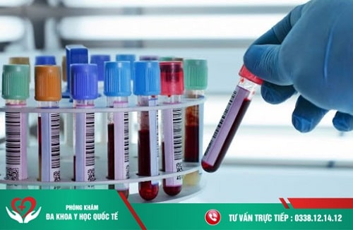Những thông tin về xét nghiệm máu mà bạn cần biết