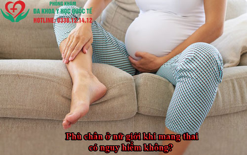 Phù chân ở nữ giới khi mang thai có nguy hiểm không?